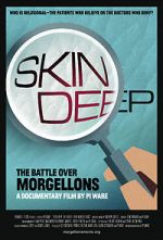 Watch Skin Deep: The Battle Over Morgellons 123moviesFree