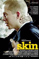 Watch Skin 123moviesFree