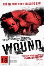 Watch Wound 123moviesFree