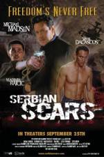 Watch Serbian Scars 123moviesFree